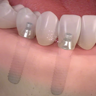 Esztétikai kezelés