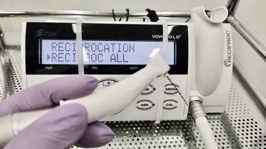 Gyökércsatorna tisztítása