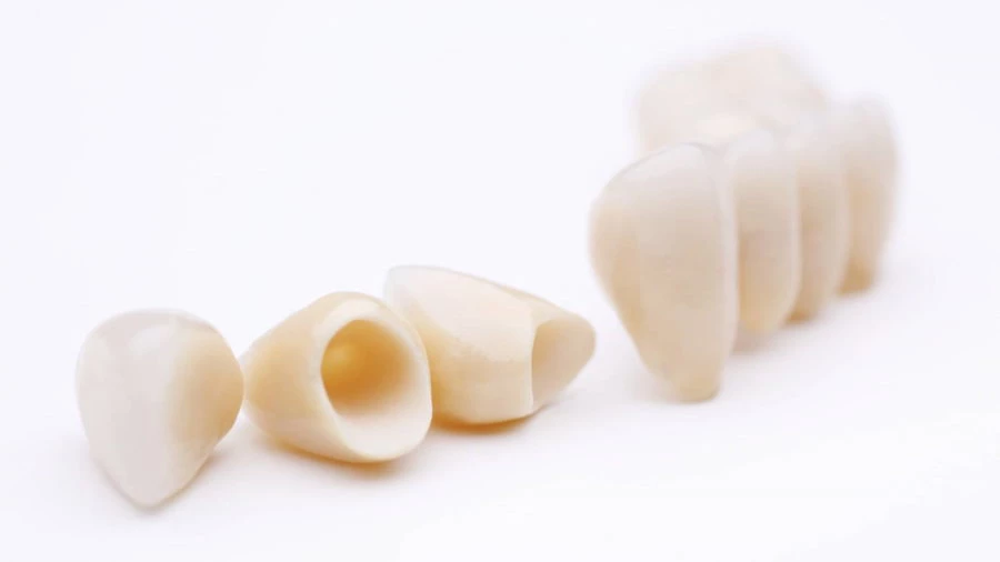 Fogpótlás gyökérkezelt fogra